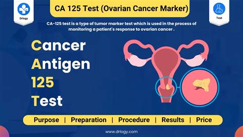 when to check ca 125